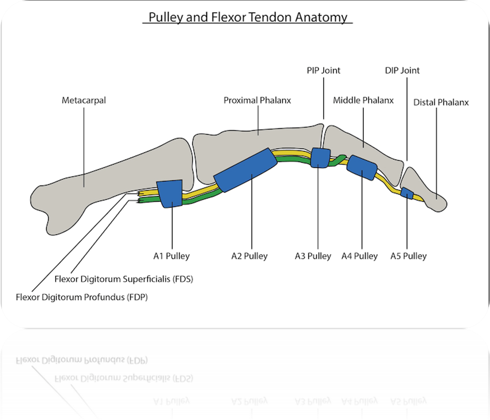 Кольцевидная связка пальцев. A1 Pulley release hand RT название операции. Digital Pulleys в медицине.